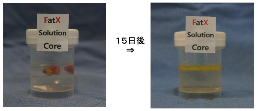 脂肪を“溶かす”＋“除去する”Wアプローチ